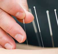 Acupuncture for Weight Loss in Midland Park, NJ