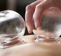 Cupping Therapy Massage in Midland Park, NJ