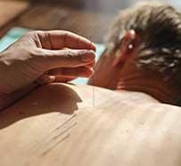 Dry Needling Therapy in Midland Park, NJ