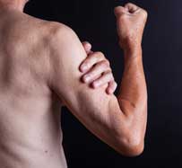 Muscle Loss Treatment | Muscle Atrophy Therapy | Midland Park, NJ 